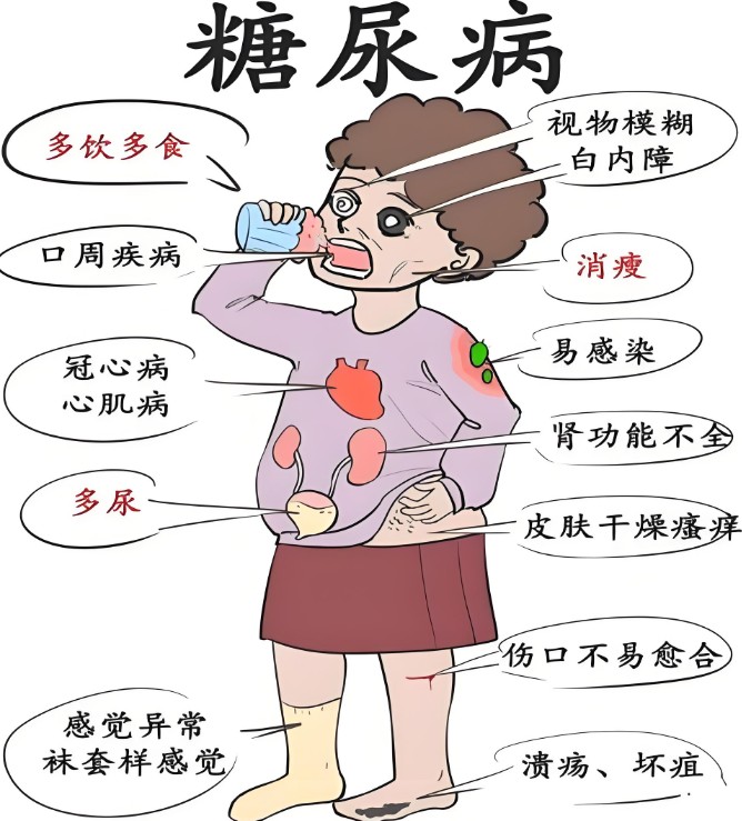 全国糖尿病“三师共管”示范中心成立