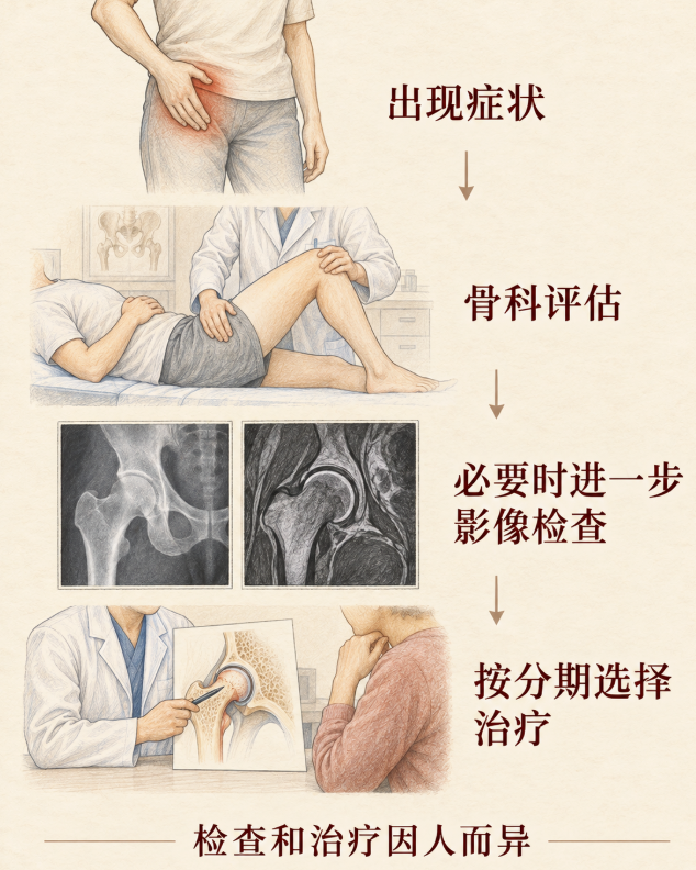 股骨头坏死究竟“坏”在哪？ 专家提醒：这四类高危人群要警惕 第 3 张